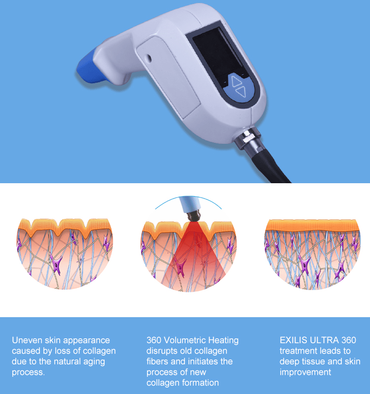 Portable Exils Body Face Skin Tighten máquina de eliminación de arrugas