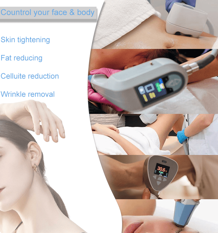 Portable Exils Body Face Skin Tighten máquina de eliminación de arrugas