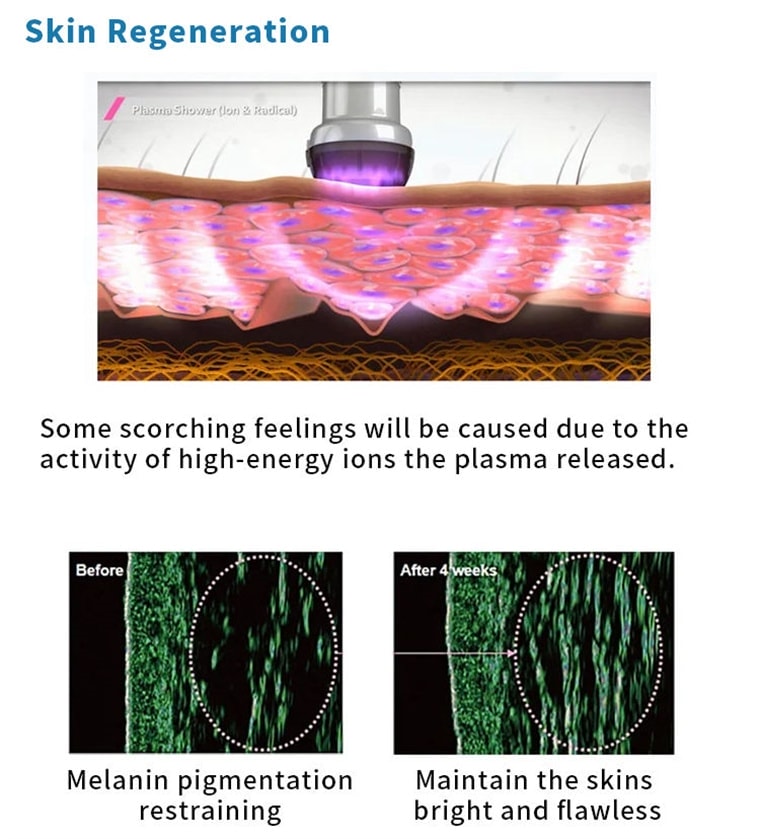 Bolígrafo de plasma