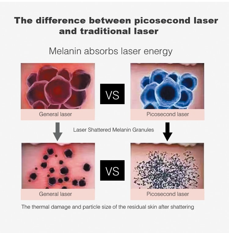 Dispositivo de belleza para el rejuvenecimiento de la piel para eliminar la pigmentación con láser de picosegundos