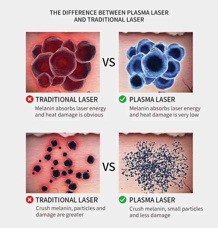 Máquinas de belleza láser de plasma facial para eliminación de manchas de acné portátiles 2 en 1