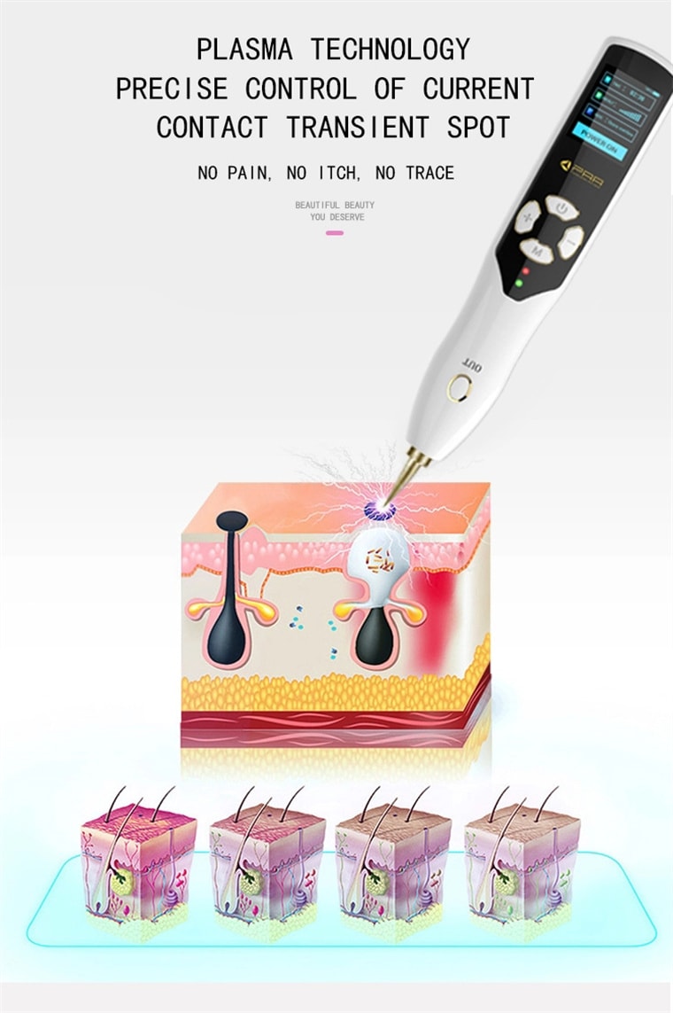 Mole Spot Sweeping Magic Pen Beauty Pecas Eliminación Spot Plasma Pen