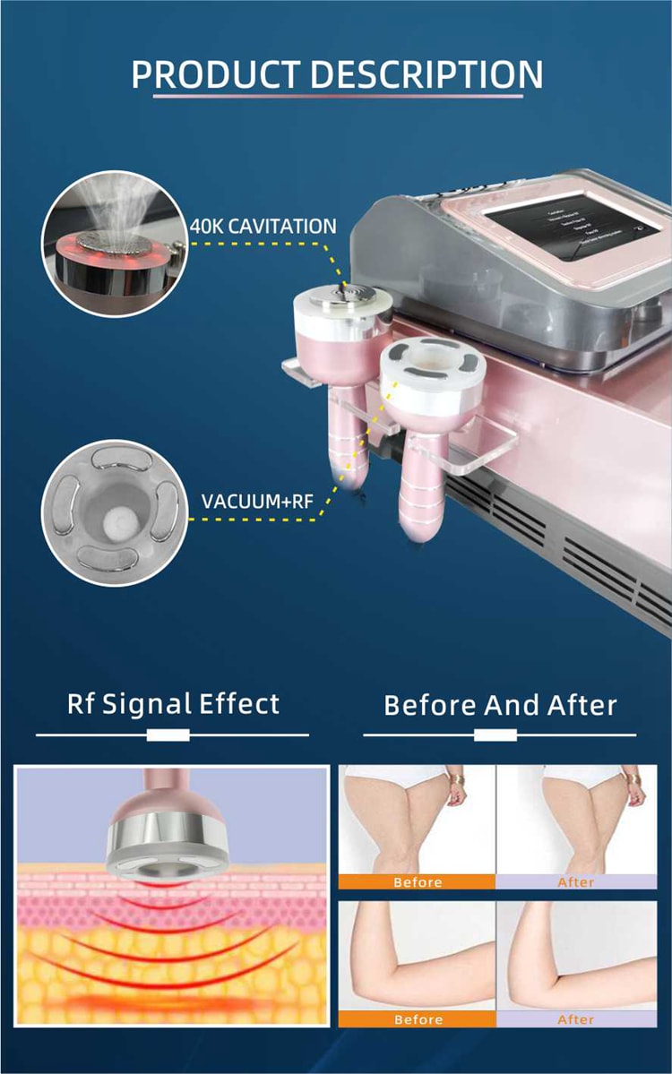 Máquinas láser de succión Lipo adelgazantes de cuerpo de vacío Rf de alta calidad