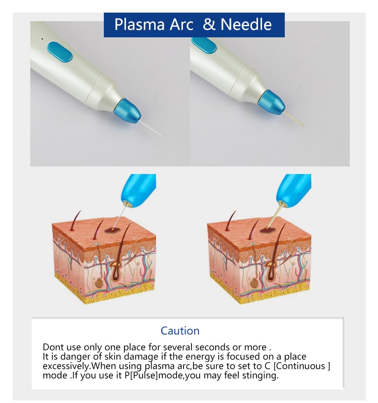 Gran oferta, láser médico de Corea, eliminador de marcas en la piel, Estiramiento facial, Plaxage Plamere, pluma de Plasma